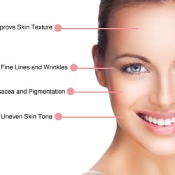 Elite Skincare & Aesthetics - Microdermabrasion