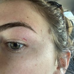 NS Eyebrow Threading - Eyebrow thread burn