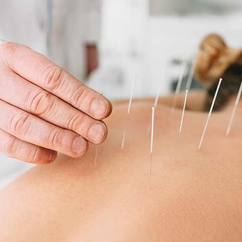 Sally Sun Acupuncture 中医针灸诊所 - Acupuncture Near Me - Santa Clara, California Sally Sun Acupuncture 中医针灸诊所 - Acupuncture Near Me - Santa Clara, California