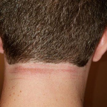 Floyd's 99 Barbershop - Irritated and scabbing skin from where barber nicked me - Barbers Near Me - Chandler, Arizona Floyd's 99 Barbershop - Irritated and scabbing skin from where barber nicked me - Barbers Near Me - Chandler, Arizona