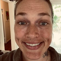 Hale Beauty - Before the treatment, did not even know how much better my skin could be. As well time and wear has make my eyes unsymmetrical