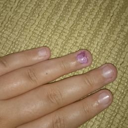 this is me after removing some nail polish