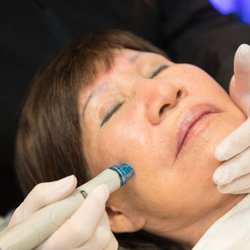 Total Glow - Terrie's mother enjoying a Hydrafacial
