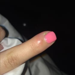 Worst manicure and pedicure experience and topped it off with a cuticle infection.