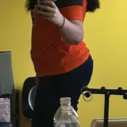 Mia Aesthetics - 3 months post op