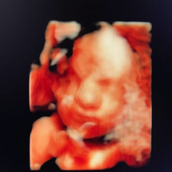 Baby in Blossom - Ultrasound Imaging Centers Near Me - Goodyear, Arizona Baby in Blossom - Ultrasound Imaging Centers Near Me - Goodyear, Arizona