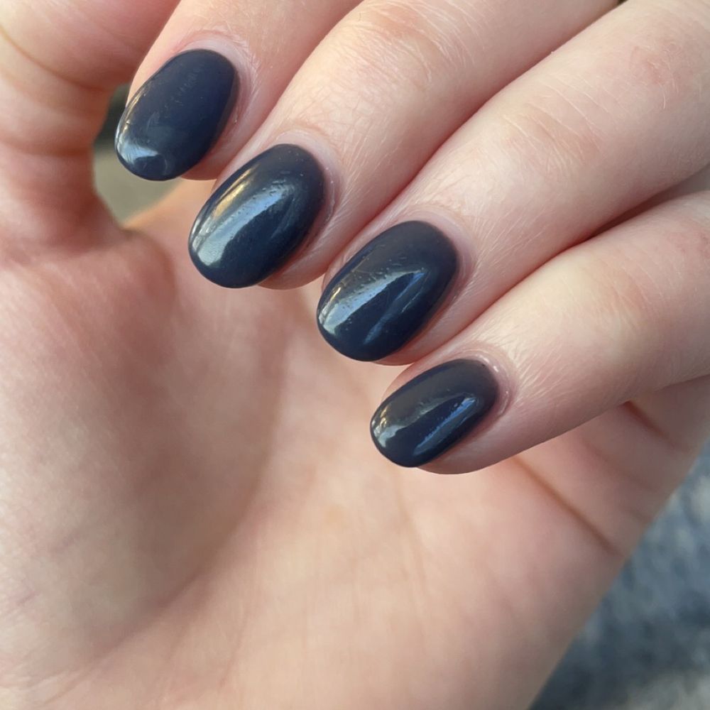 Visible imperfections on my nails Visible imperfections on my nails