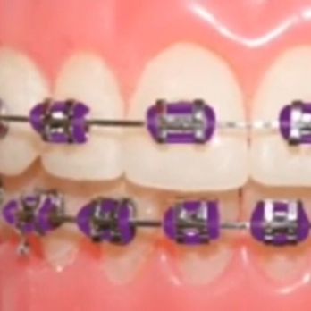 T. Scott Jenkins, DDS, PA - The color I have - Lupus Warrior "Purple" - Orthodontists Near Me - Aberdeen, Maryland T. Scott Jenkins, DDS, PA - The color I have - Lupus Warrior "Purple" - Orthodontists Near Me - Aberdeen, Maryland