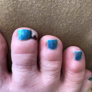 Envy Nails - Ouch! Ended up getting cut. It hurt and bled! - Nail Salons Near Me - Surrey, British Columbia Envy Nails - Ouch! Ended up getting cut. It hurt and bled! - Nail Salons Near Me - Surrey, British Columbia