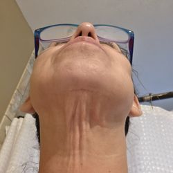 Houston Plastic and Reconstructive Surgery - I still can't afford to correct right now but I'm saving. 2 necklaces with Dr Fred Aguilar and this is the end results.