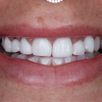 Stunning Smiles - before - Cosmetic Dentists Near Me - Las Vegas, Nevada Stunning Smiles - before - Cosmetic Dentists Near Me - Las Vegas, Nevada
