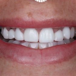 Stunning Smiles - Before