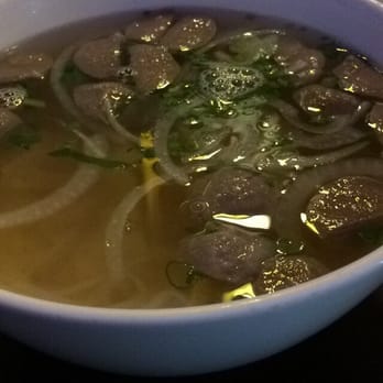 Pho Tower - Was suppose to be a meatball and tendon pho, as you can see there was no "tendon"(2-3 pieces) - Vietnamese Near Me - Kansas City, Missouri Pho Tower - Was suppose to be a meatball and tendon pho, as you can see there was no "tendon"(2-3 pieces) - Vietnamese Near Me - Kansas City, Missouri