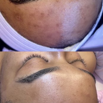 Sacred Skin by Steph - Brightening Facial and treatment plan - Acne Treatment Near Me - Spring Valley, Nevada Sacred Skin by Steph - Brightening Facial and treatment plan - Acne Treatment Near Me - Spring Valley, Nevada