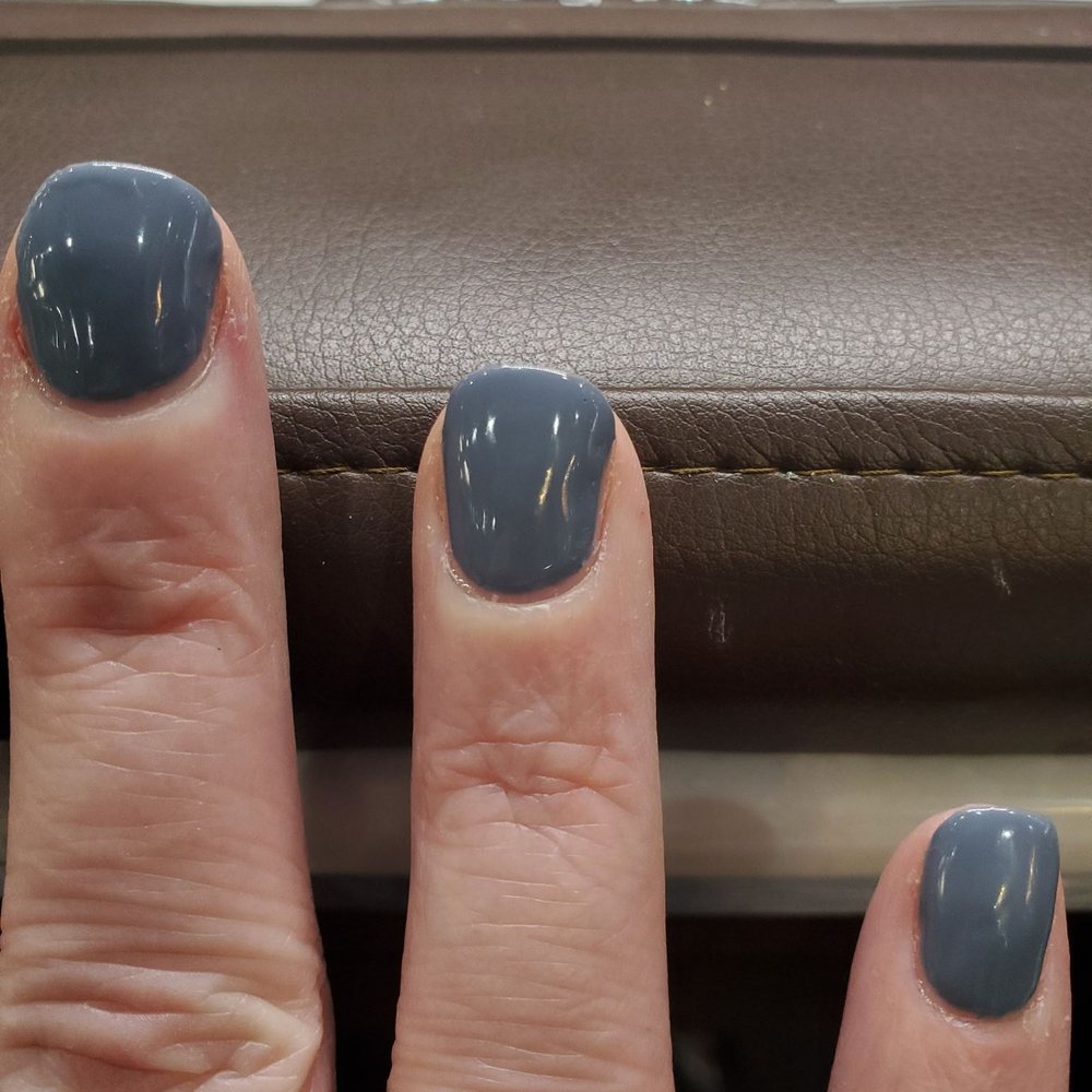 Ring finger nail bulged out to the side.