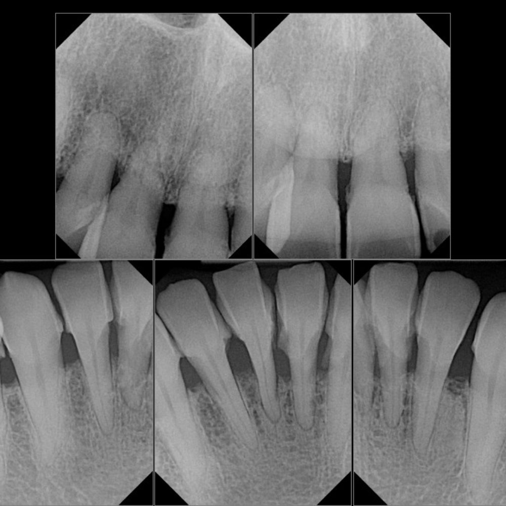 Bliss Dentistry | Family and Cosmetic Dentistry - Cosmetic Dentists Near Me - Campbell, California Bliss Dentistry | Family and Cosmetic Dentistry - Cosmetic Dentists Near Me - Campbell, California