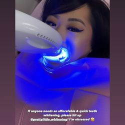 Pretty Little Whitening