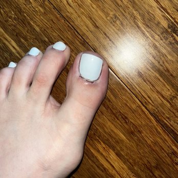 Stellar Nail Spa - A week after pedicure my toe is still hurting. - Nail Salons Near Me - San Antonio, Texas