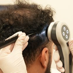 Sule Hair Transplant - Hair Analyzing by TrichoLAB