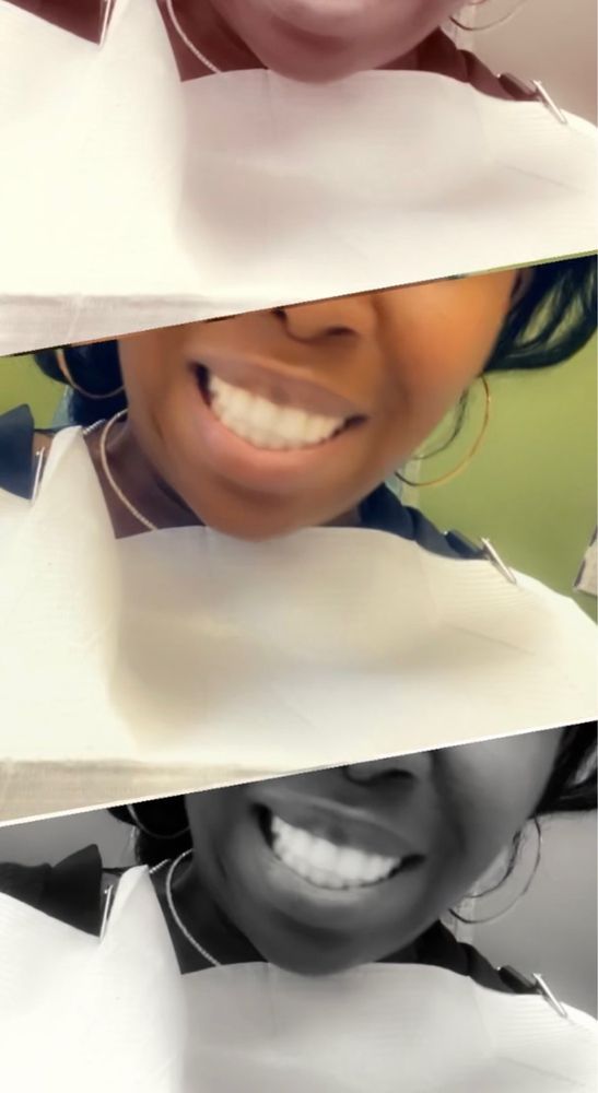 BELBAR DENTAL ASSOCIATES Updated August 2024 812 Hamilton St, Somerset, New Jersey