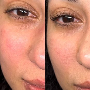 Luxury Aesthetixx - Eyelash Lift + tint - Eyebrow Services Near Me - Roseville, California Luxury Aesthetixx - Eyelash Lift + tint - Eyebrow Services Near Me - Roseville, California