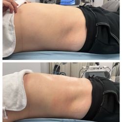 Radiance spa - The results after just one session are incredible.