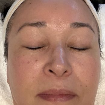 The Skin Café - Facial completed (before eyebrow tint). - Skin Care Near Me - Gilbert, Arizona The Skin Café - Facial completed (before eyebrow tint). - Skin Care Near Me - Gilbert, Arizona