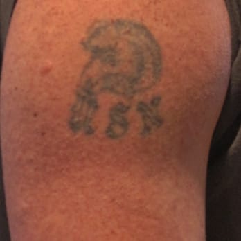 American Electric Tattoo - The before, from 1978 - Tattoo Near Me - Los Angeles, California