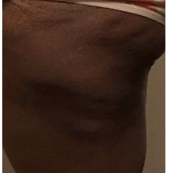 Perfections body sculpt - Before