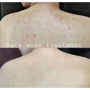 Jin Aesthetics - Skin Care Near Me - Dublin, California Jin Aesthetics - Skin Care Near Me - Dublin, California