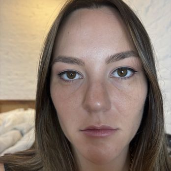 UPKEEP - Uneven eyelid/eyebrow even with makeup on - Medical Spas Near Me - New York, New York UPKEEP - Uneven eyelid/eyebrow even with makeup on - Medical Spas Near Me - New York, New York