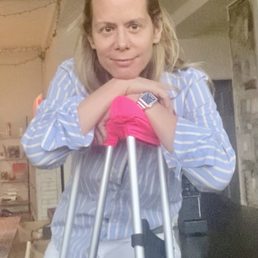 Healing after arthroscopic labral surgery