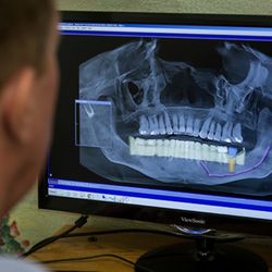 Tab Boyle, DDS - Digital x-rays, ct. Scan