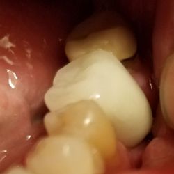 Hugh T Keeffe, DDS
