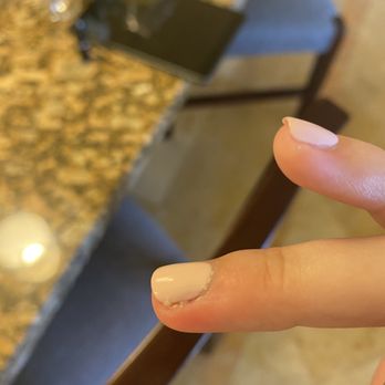 Happiest Nails & Spa - Infected finger - Nail Salons Near Me - Oceanside, California Happiest Nails & Spa - Infected finger - Nail Salons Near Me - Oceanside, California