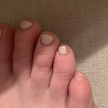 Magic Nails Oakbrook Terrace - Chipped toes - Nail Salons Near Me - Oakbrook Terrace, Illinois