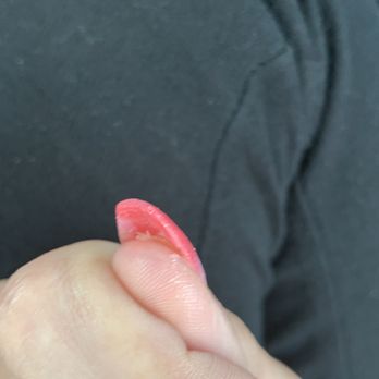 AJ Nails - You can see my natural thumb nail is splintered under my acrylic - Day Spas Near Me - University Park, Florida