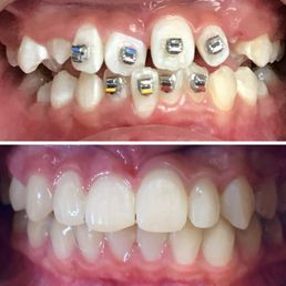 Before and After photo Before and After photo