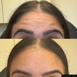 Allumine Skin Clinic