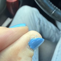 2000 Nails - Missing paint on side of nail.