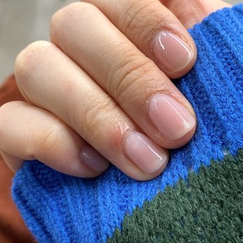 Coco Nails art - Four days after with finger looking swollen, shiny, and red - Nail Salons Near Me - New York, New York Coco Nails art - Four days after with finger looking swollen, shiny, and red - Nail Salons Near Me - New York, New York