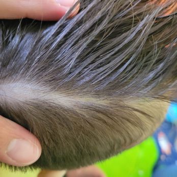 Silly Willy Kids Cuts - Huge bald spot - Kids Hair Salons Near Me - Lancaster, California Silly Willy Kids Cuts - Huge bald spot - Kids Hair Salons Near Me - Lancaster, California