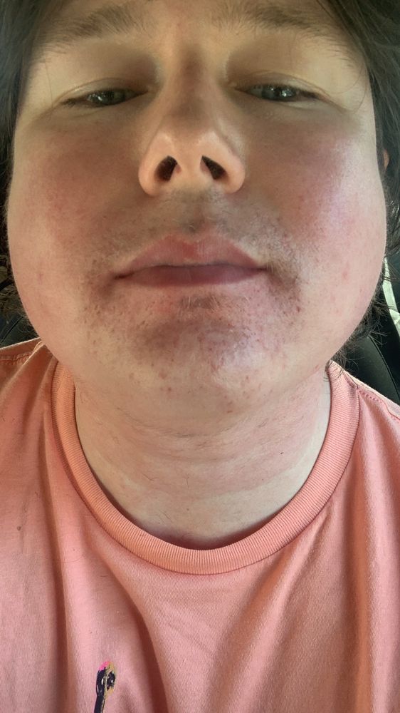 ELECTROLYSIS BY JD & ASSOCIATES Updated April 2024 13 Reviews