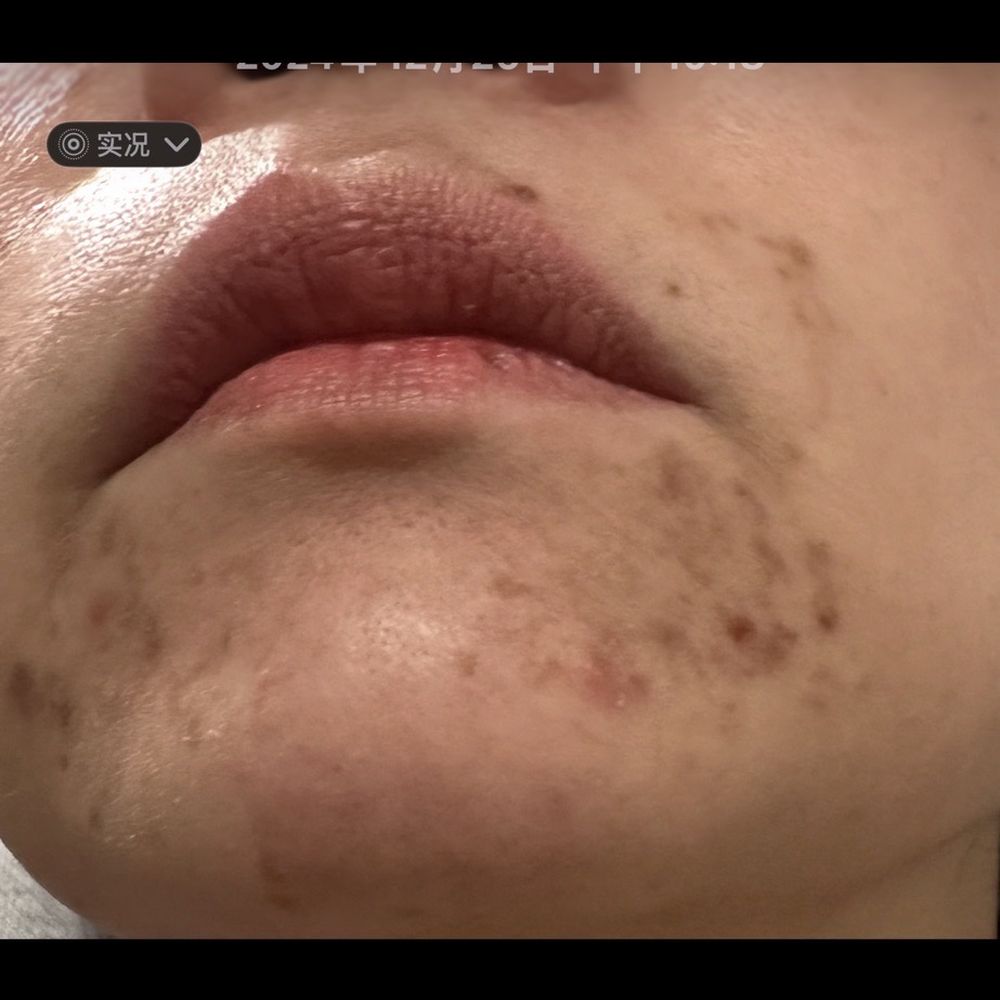 New Life Spa - Please don't go to this store. - Skin Care Near Me - Newark, California
