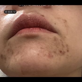 New Life Spa - Please don't go to this store. - Skin Care Near Me - Newark, California New Life Spa - Please don't go to this store. - Skin Care Near Me - Newark, California