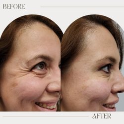 Obtain Confidence | Med Spa