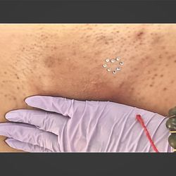 D.beauty - After Brazilian & add on heart shape vajazzle