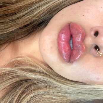 Las Vegas Aesthetics - Medical Spas Near Me - Las Vegas, Nevada Las Vegas Aesthetics - Medical Spas Near Me - Las Vegas, Nevada