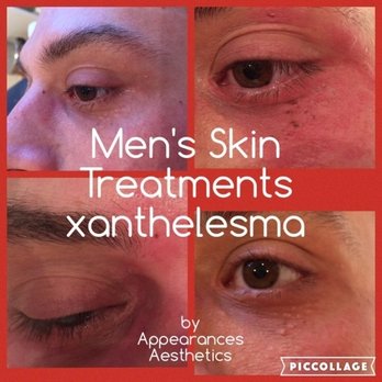Appearances Aesthetics - Permanent Makeup Near Me - Chislehurst, KEN Appearances Aesthetics - Permanent Makeup Near Me - Chislehurst, KEN