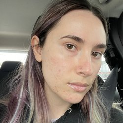 Audi Skin - Right after my facial with Audi skin-my complexion is so calm and clear and free of texture
